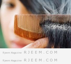 اسباب وعلاج قشرة الشعر