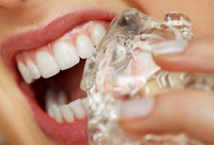 ما هي أسباب حساسية الاسنان؟