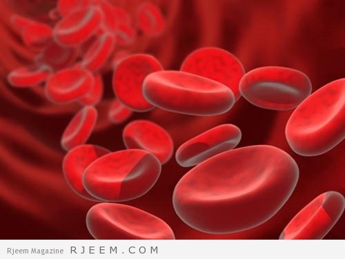 فقر الدم - اسباب وعلاج الانيميا 