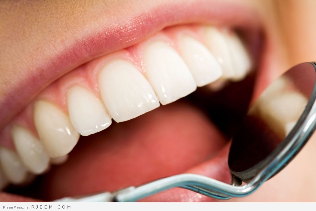 تسوس الاسنان - اسباب تسوس الاسنان وطرق العلاج والوقاية منه