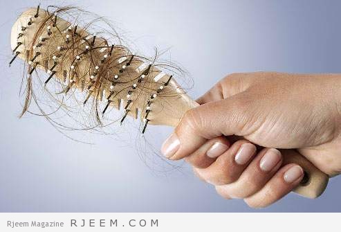 10 اسباب طبية لتساقط الشعر
