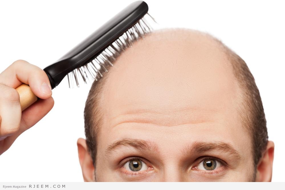 10 اسباب طبية لتساقط الشعر