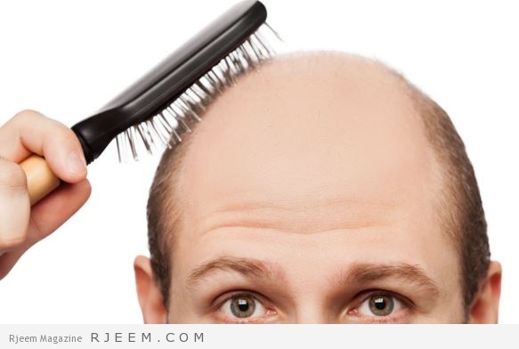 7 علاجات طبيعية للتخلص من تساقط الشعر