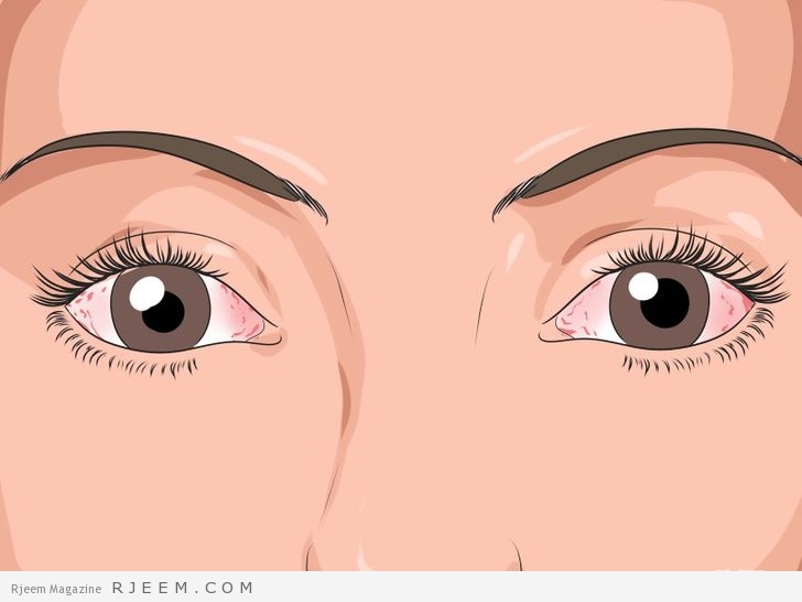 اكثر من 10 نصائح للمحافظة على سلامة العينين