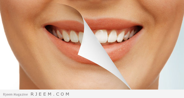 15 طريقة طبيعية لازالة اصفرار الاسنان 