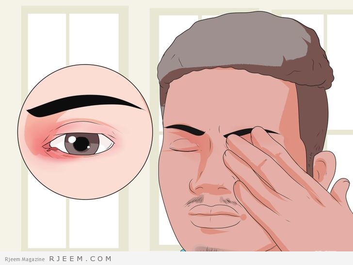 اكثر من 10 نصائح للمحافظة على سلامة العينين