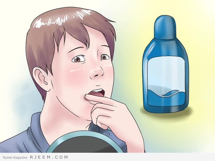 16 علاج منزلي لتقرحات الفم
