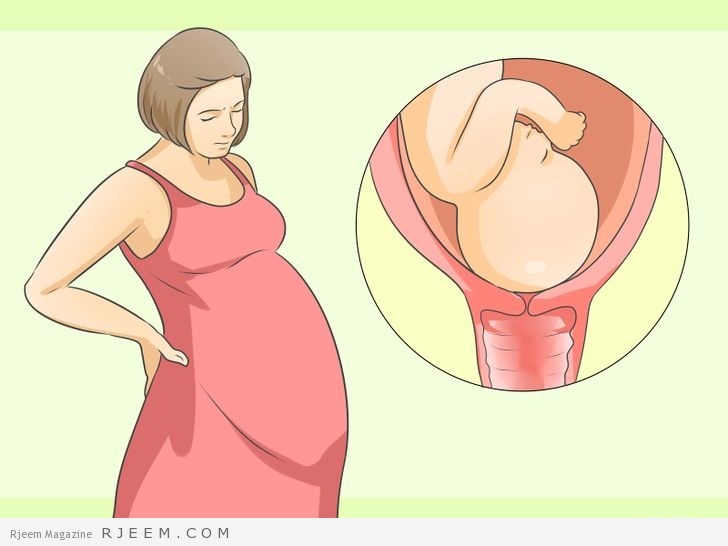 8 اسباب الولادة مبكرة