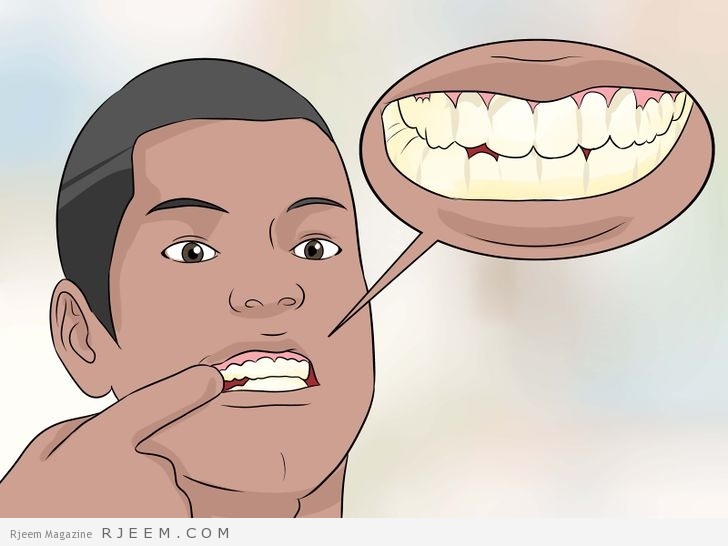 5 فوائد لخيط الاسنان