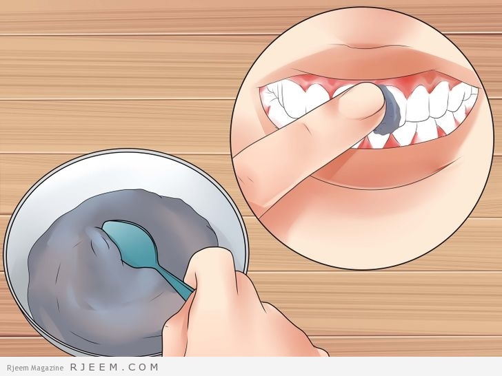11 طريقة لتبييض الاسنان في المنزل