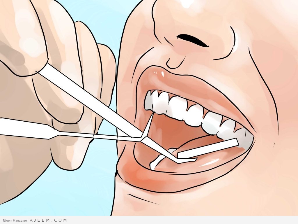5 خلطات طبيعيه لتبييض الاسنان
