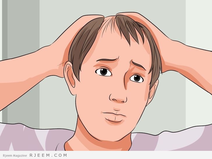 5 طرق لمنع تساقط الشعر بغزارة