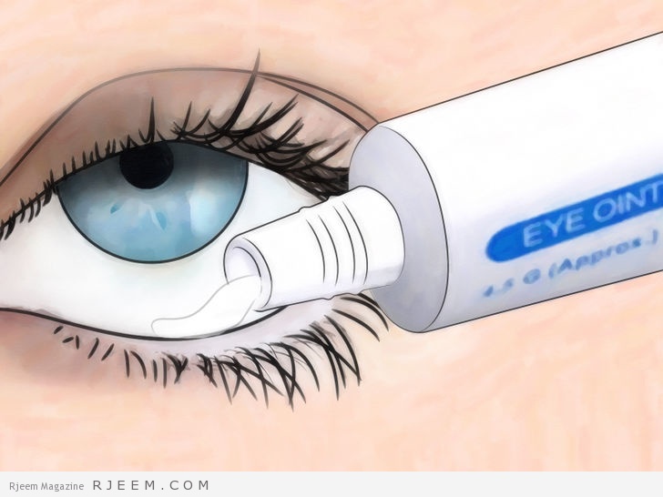 8 علاجات منزلية لجفاف العين والجفون