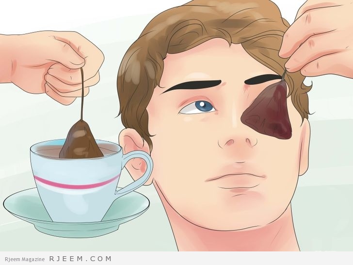 10 طرق لعلاج انتفاخ العين منزليا