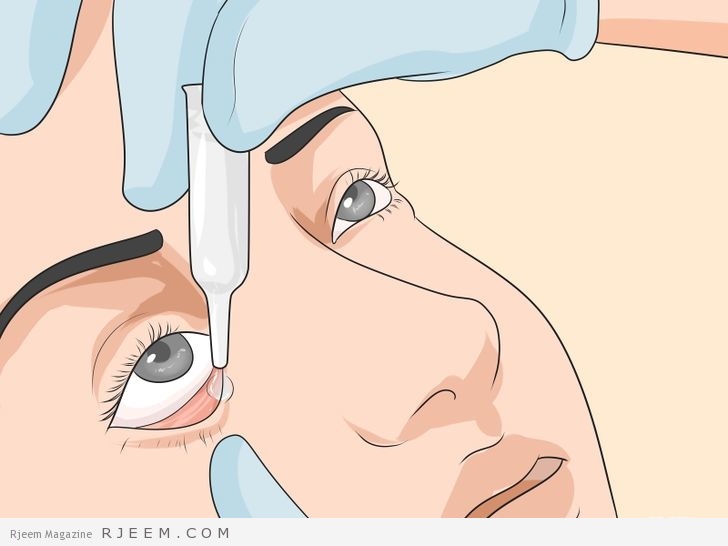 حساسية العين اسباب وعلاج