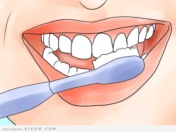 10 وصفات طبيعية لتبييض الاسنان