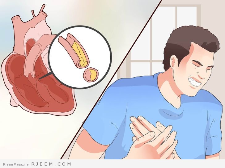6 تغيرات مهمة في حياة مريض القلب