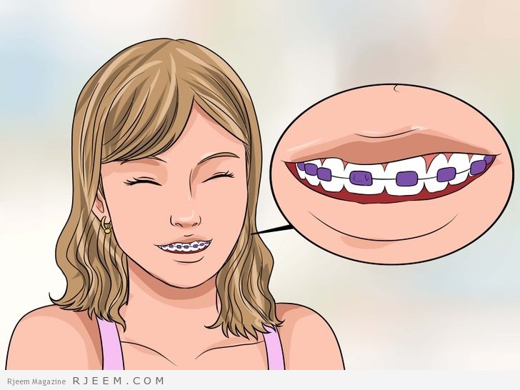 طرق تخفيف الم تقويم الاسنان مجلة رجيم