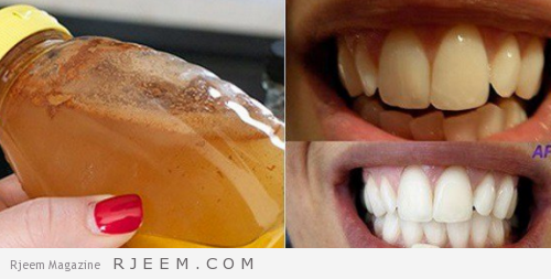Blanchissez-vos-dents-avec-un-produit-naturel-500x253-500x253