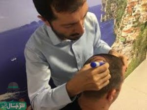عمليات زراعة الشعر في قطر 