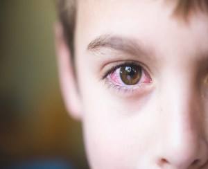 حماية الأطفال من أمراض العيون فى المدارس