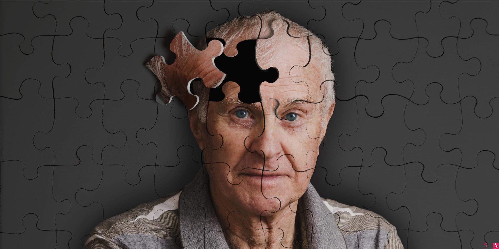 نتيجة بحث الصور عن ‪dementia+young man‬‏