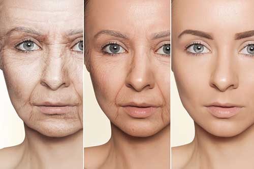 هاجس الكبريت مثيرة للجدل  كيفية علاج تجاعيد الوجه بالطب البديل - مجلة رجيم