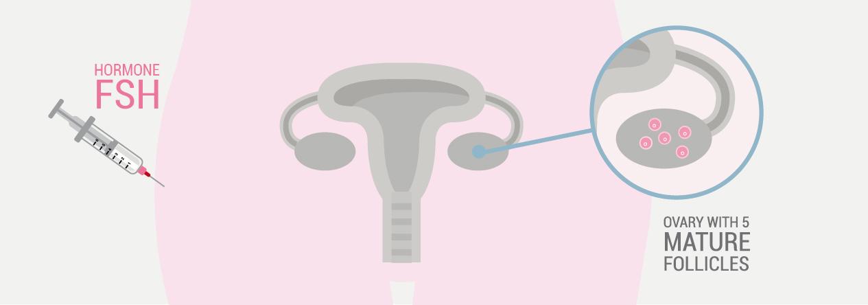 ارتفاع هرمون fsh والحمل