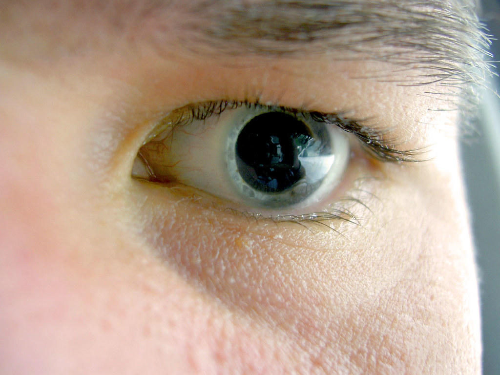 علاج امراض العيون