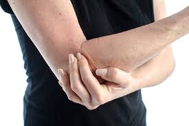 علاج ألآم الذراع الأيمن