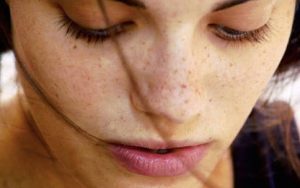16 علاج لإزالة البقع السوداء في الوجه