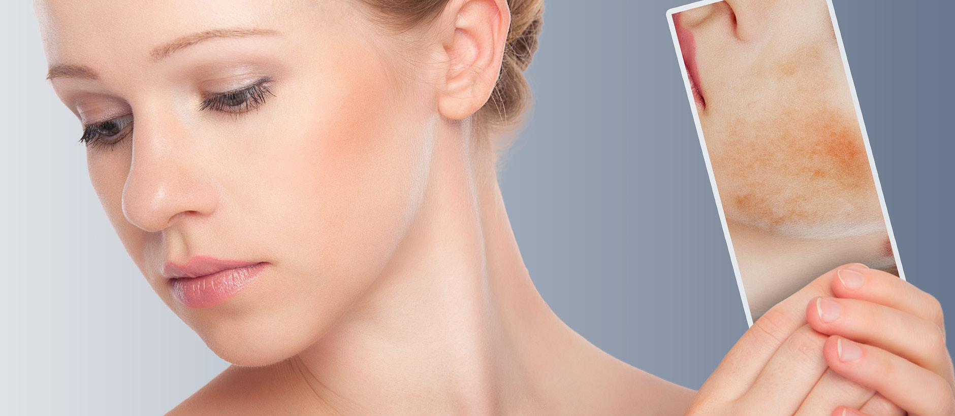 علاج البقع الداكنة في الوجه