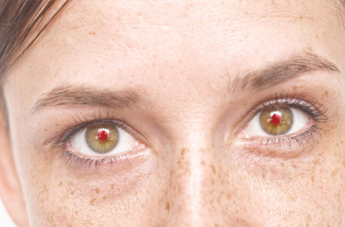 21 وصفة لعلاج احمرار العين بالاعشاب