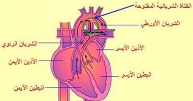 ضعف عضلة القلب
