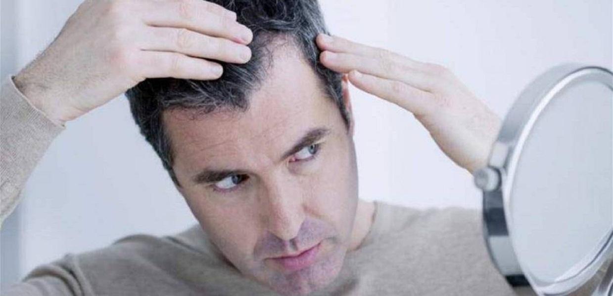  اسباب ظهور الشعر الابيض