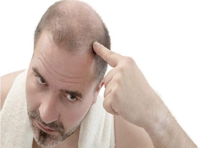 علاج تساقط الشعر بالاعشاب .