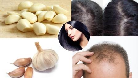 علاج تساقط الشعر بالثوم لتقوية الشعر من الجذور
