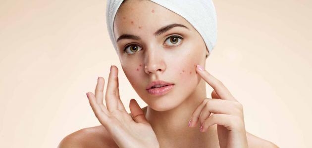 فوائد الرمان للبشرة الدهنية لعلاج مسام الوجه الكبيرة