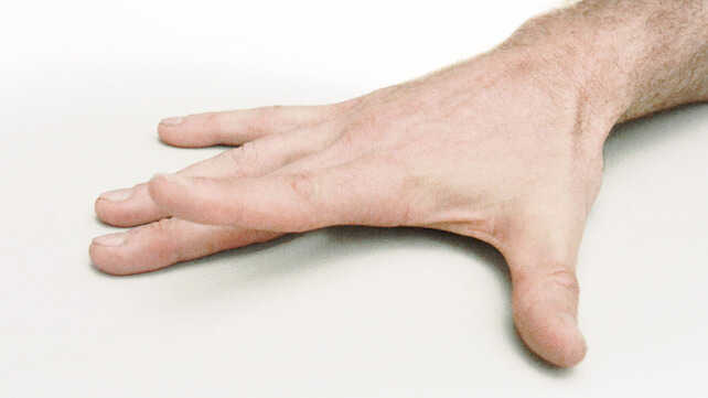 تمارين اليد لتخفيف التهاب المفاصل