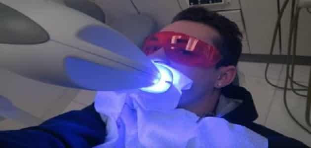 تبييض الاسنان في عيادة الطبيب .